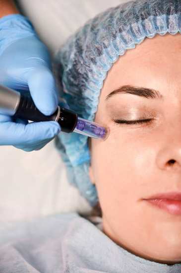 الديرما بن - DERMA PEN