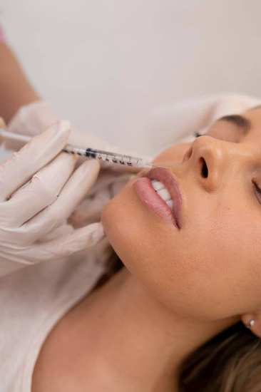 Lip Fillers - حقن الشفاه